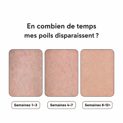 Epilateur lumière pulsée